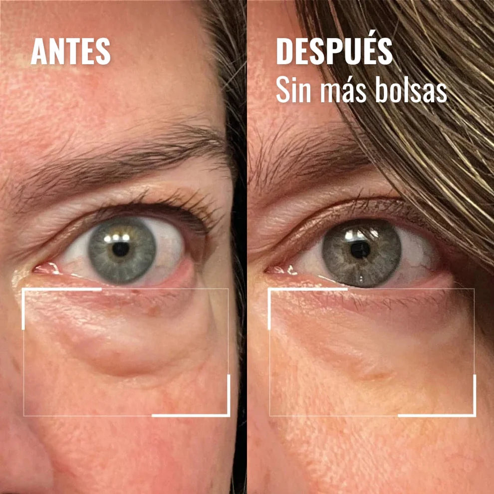 Di adiós a las ojeras y la cara cansada