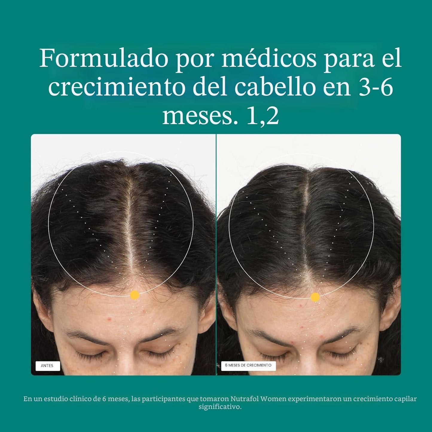 Cabello visiblemente más grueso, más abundante y más fuerte en 3 a 6 meses