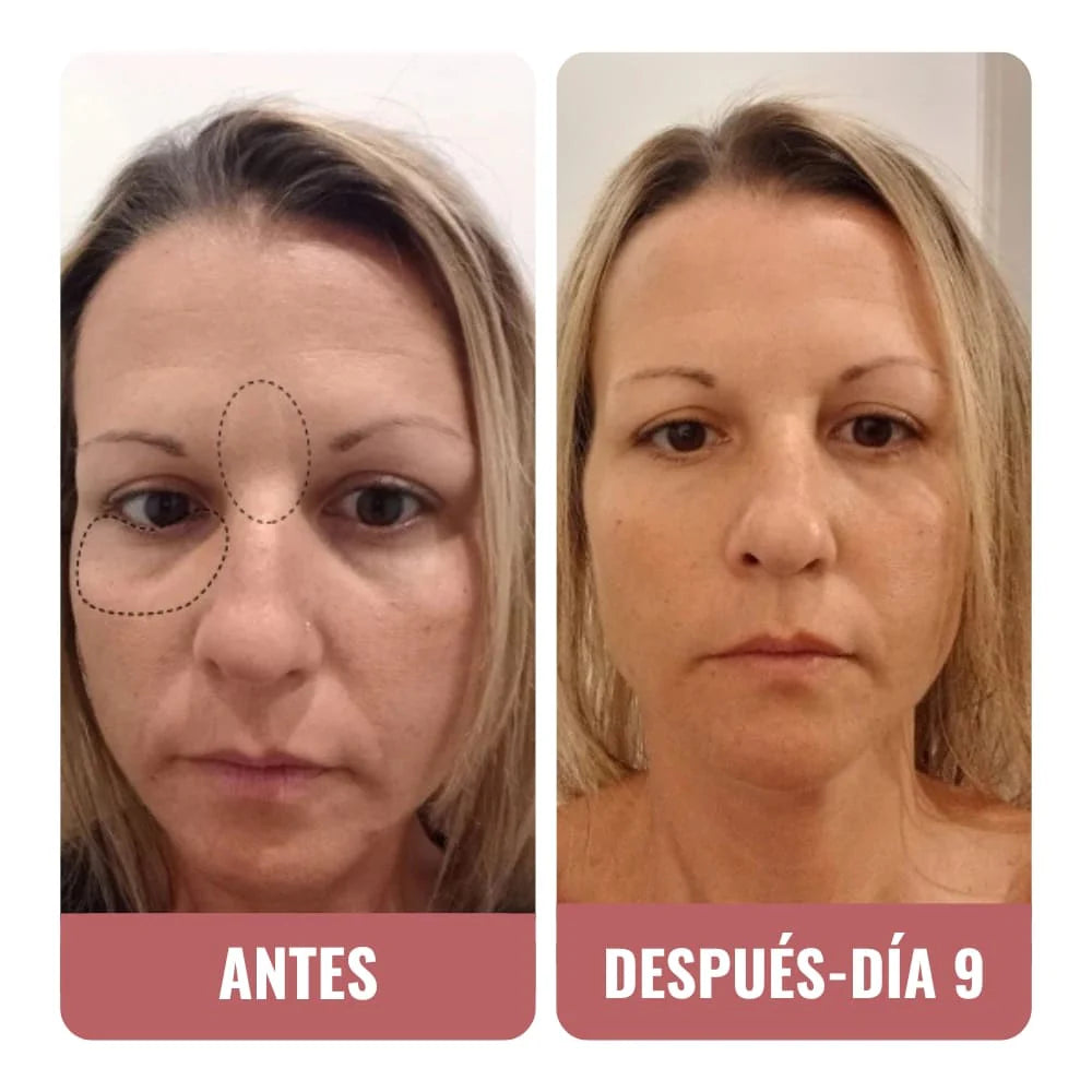 Di adiós a las ojeras y la cara cansada