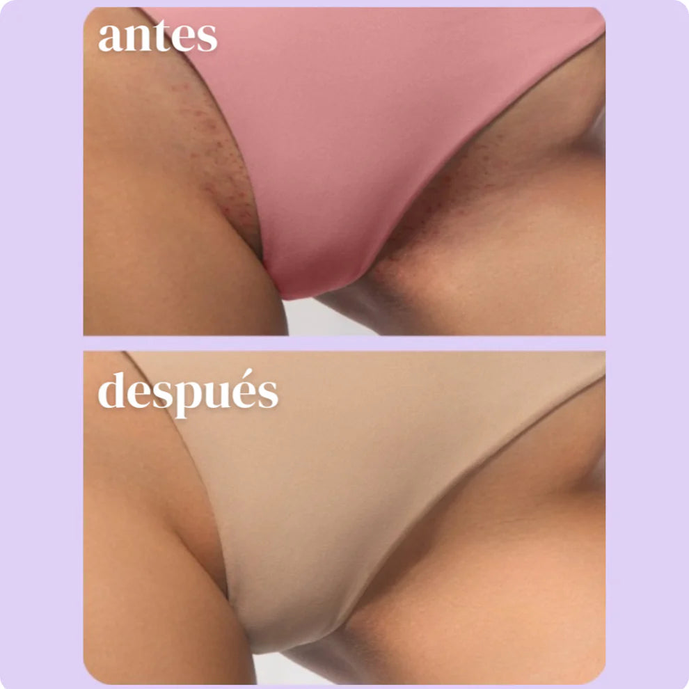 Aclara y perfuma tu zona íntima de forma natural!!