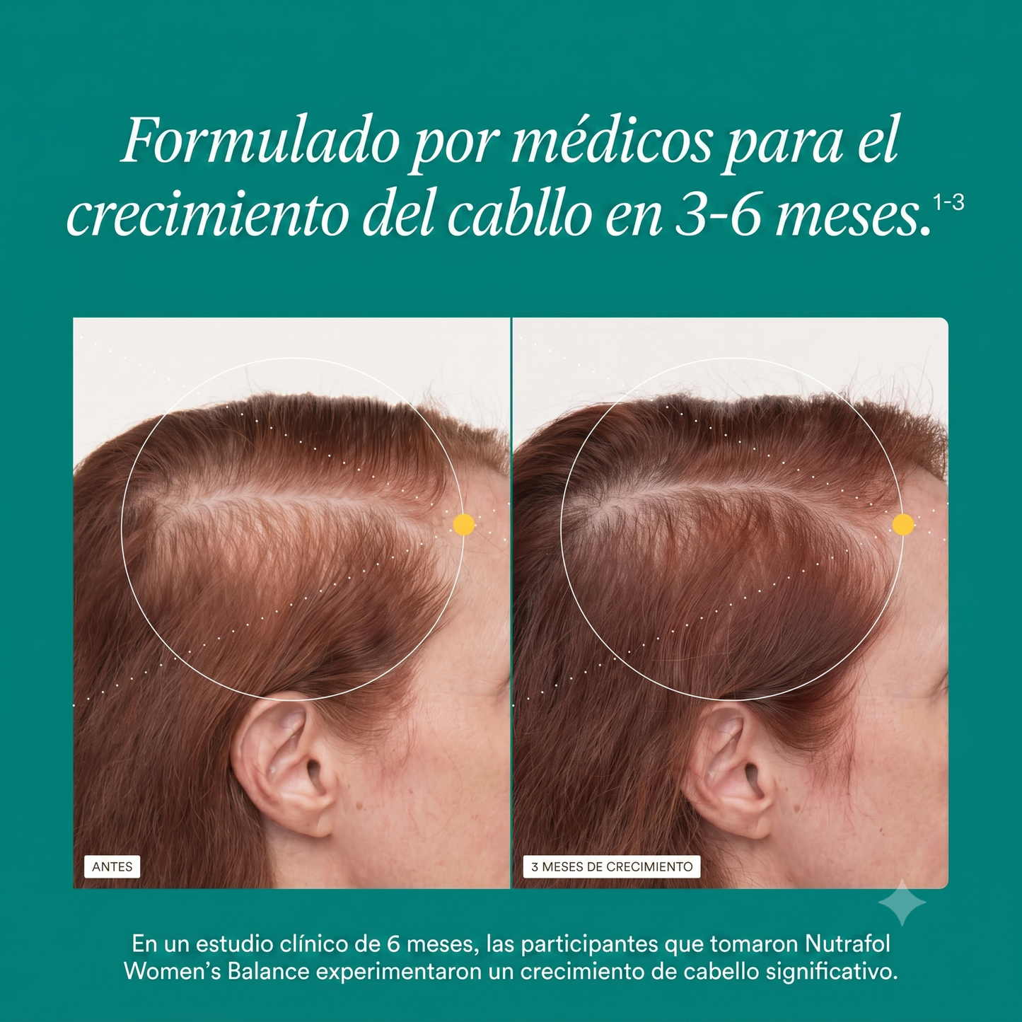 Cabello visiblemente más grueso, más abundante y más fuerte en 3 a 6 meses
